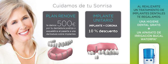 promoción en implantes dentales en Madrid