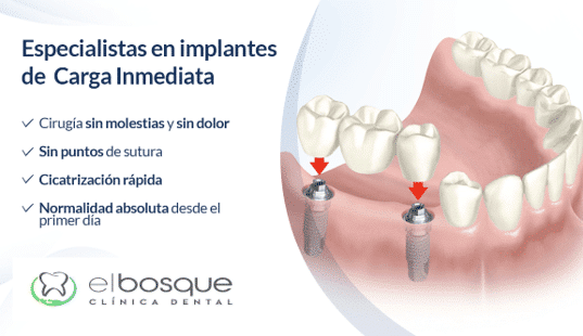 Implantes dentales en 24 horas en Villaviciosa de Odón y Boadilla del Monte